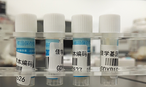 【佳學(xué)基因檢測(cè)】做Bosch-Boonstra-Schaaf視神經(jīng)萎縮綜合征基因解碼、<a href=http://www.hncxn.com/tk/jiema/cexujishu/2021/31933.html>基因檢測(cè)</a>需要多長(zhǎng)時(shí)間？