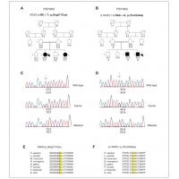 【佳學基因檢測】<font color='red'><font color='red'>精神分裂</font></font>癥患者找到致病基因：案例分享